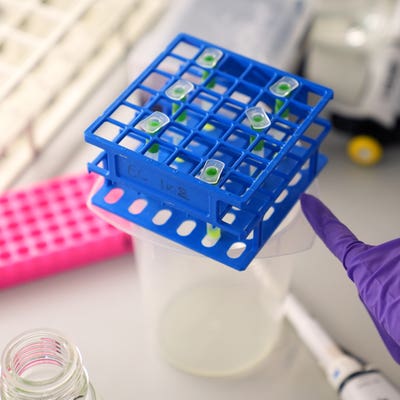 AI could ‘supercharge’ fight against cancer, researchers say