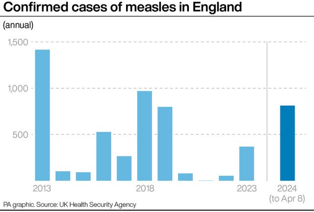 HEALTH NHS Measles