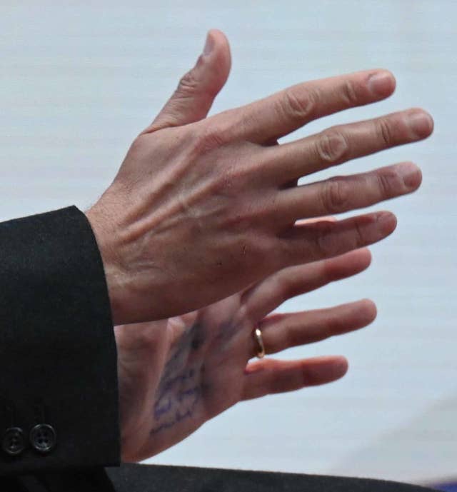 Tory party chairman Greg Hands with writing on his palm during an interview on Sunday With Laura Kuenssberg