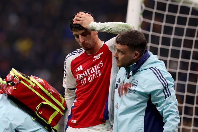 Kai Havertz holds his head as he leaves the field after suffering a cut