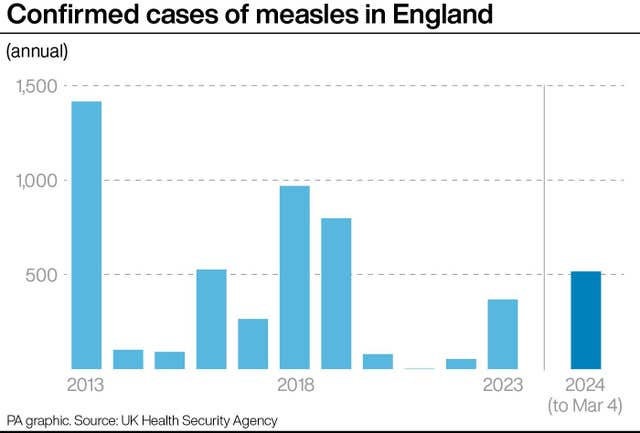 HEALTH Measles