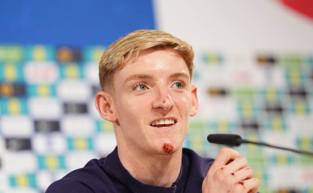 Anthony Gordon sports a graze on his chin during an England press conference following his bike crash