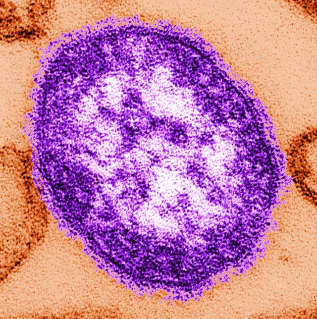 UK Measles elimination status