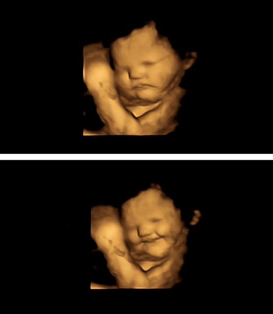 Babies in the womb ‘smile’ for carrots and grimace for greens, scans