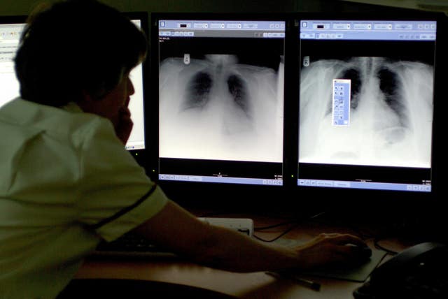 A radiologist looking at chest X-rays