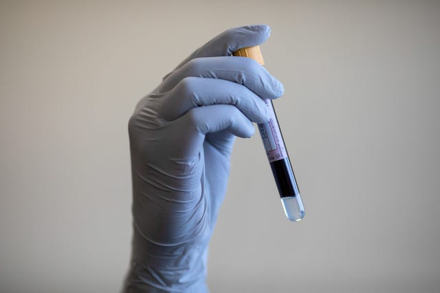 A person wearing surgical gloves holds up a vial of blood