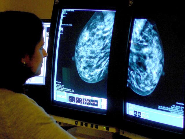 Drugs hope for cancer risk women