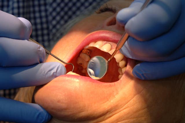 Checking condition of teeth with a visit to the dentist