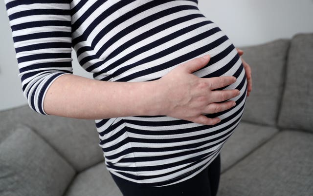 A pregnant woman wearing a black-and-white striped top holding her stomach with both hands