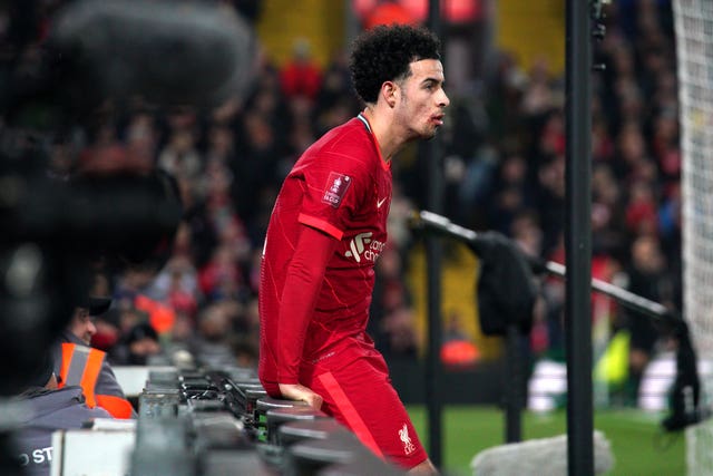 Liverpool’s Curtis Jones with an apparent injury to the face