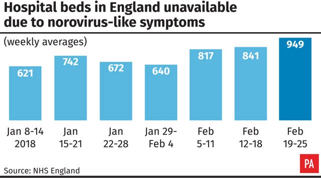 Hospital beds in England unavailable due to norovirus-like symptoms. 