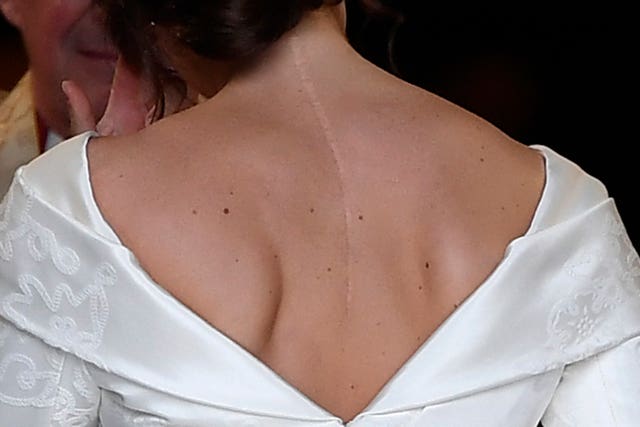 Eugenie's dress was designed to show her operation scar. Toby Melville/PA Wire