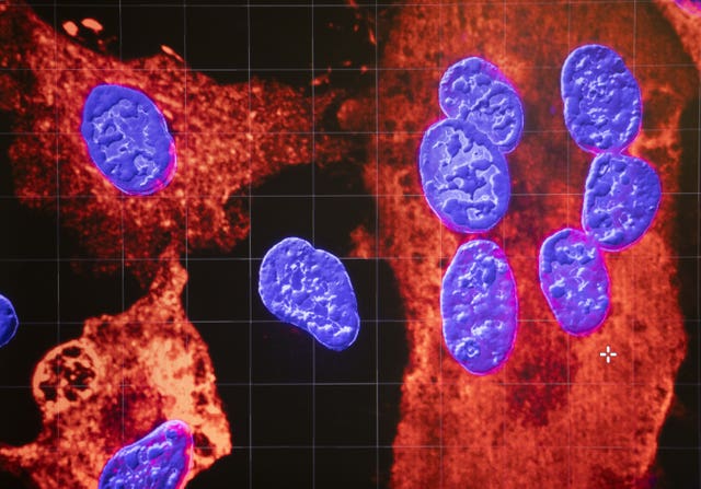 Infected cell nuclei