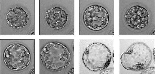 Embryo breakthrough ‘may cut multiple IVF births