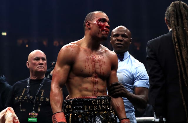 Chris Eubank was left bleeding after a cut above his eye (Peter Byrne/PA)