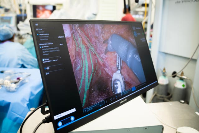 UK&rsquo;s first AI driven surgery in a colorectal procedure