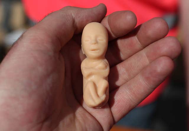 A plastic Fetus on sale at at a pro-life demonstration from Stand up for Life in Merrion Square, Dublin (Niall Carson/PA)