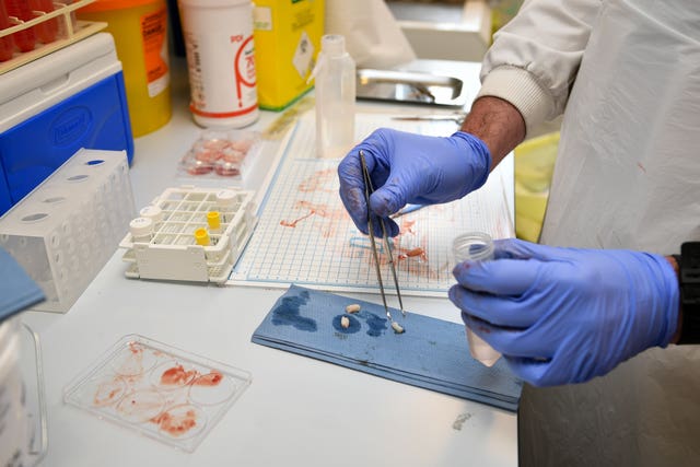 Samples of human umbilical cord are dissected and prepared by a lab technician