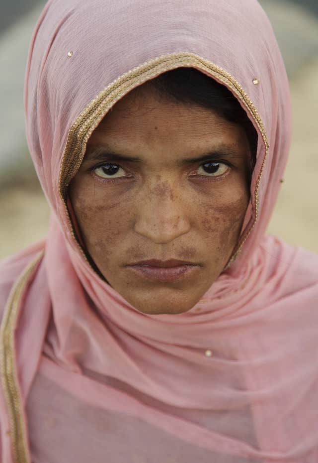 Shawkat Ara, 38, in the Kutubalong camp, Bangladesh (Simon Murphy/SCIAF)