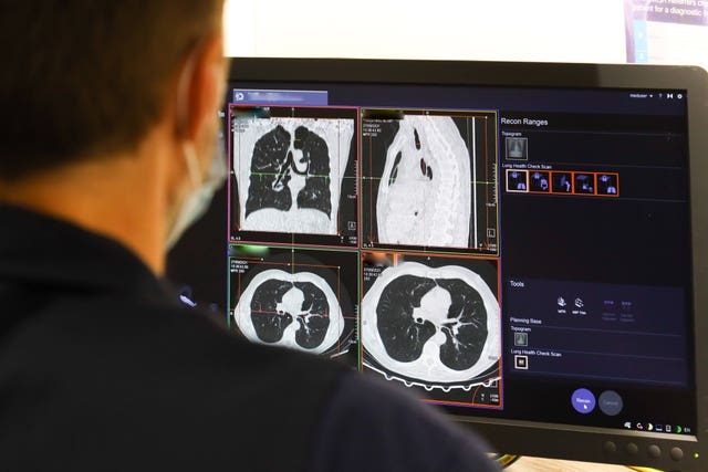 NHS Targeted Lung Health Check Programme