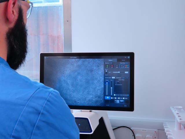 UK volunteers could be given the first dose of a potential vaccine within the next week