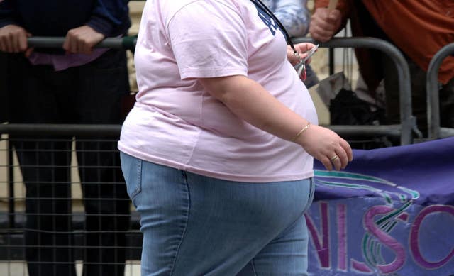 The waist of an obese woman