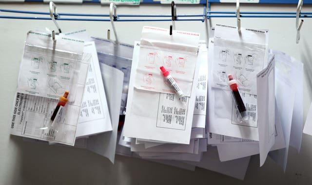Blood tests