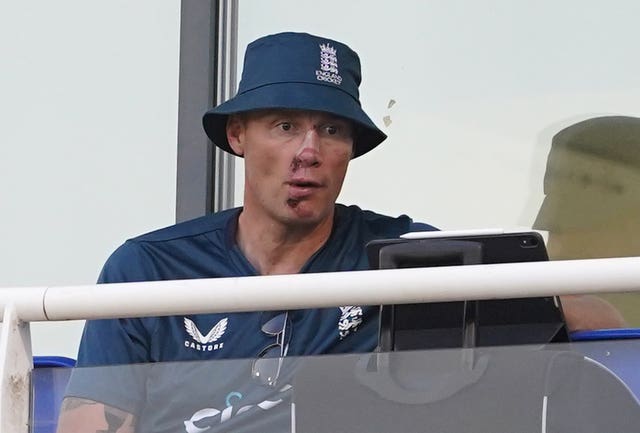 Andrew Flintoff with facial scars clearly visible sits on the England players' balcony at Cardiff last year