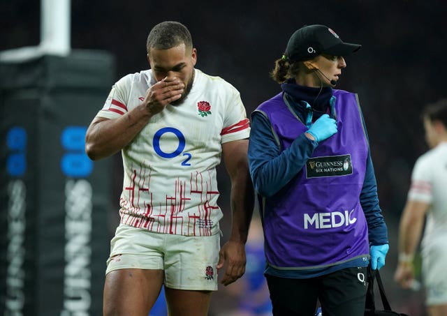 Ollie Lawrence leaves the field injured against France