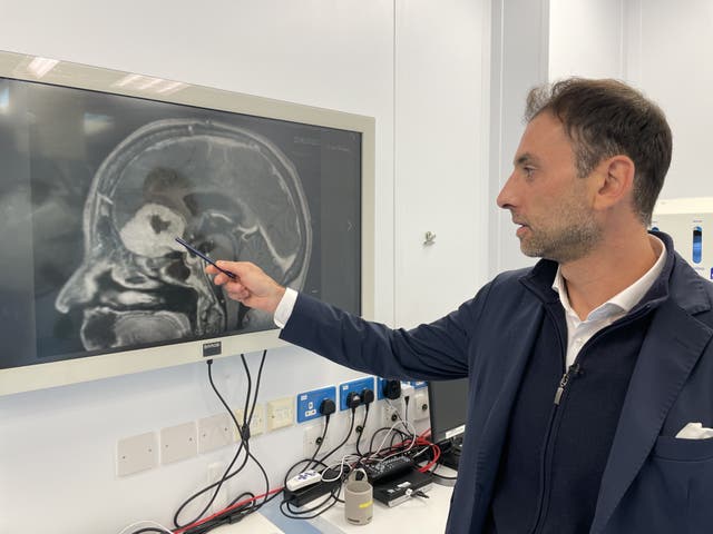 Anastasios Giamouriadis pointing at a brain scan image