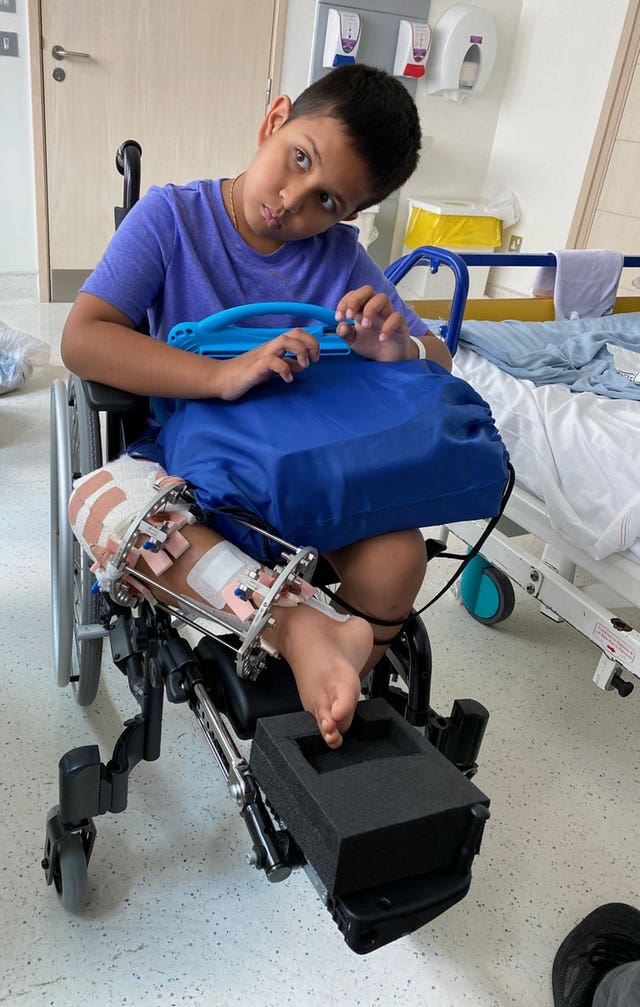 Vivaan Sharma with a frame on his leg after leg-lengthening surgery 