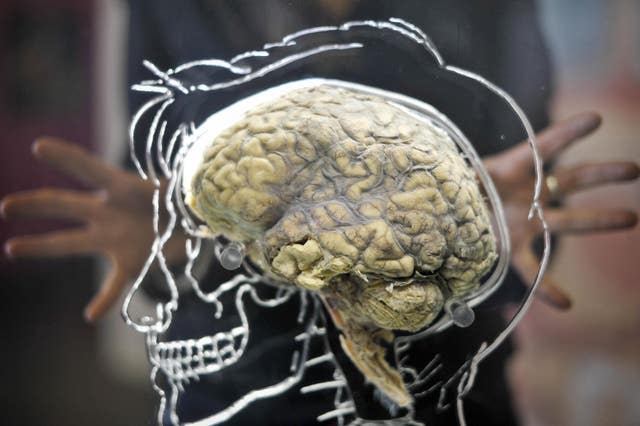 Turns out the human brain isn't as unique as we'd like to think - The Irish News Turns out the human brain isn't as unique as we'd like to think - The Irish News