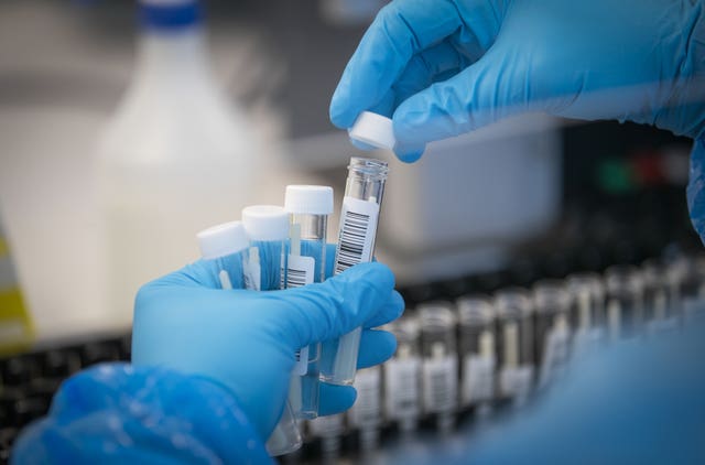 Patients' samples are transferred by scientists into plates
