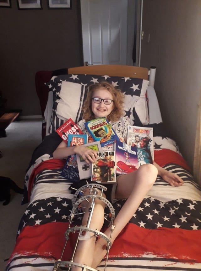 James Wood with his leg in a frame