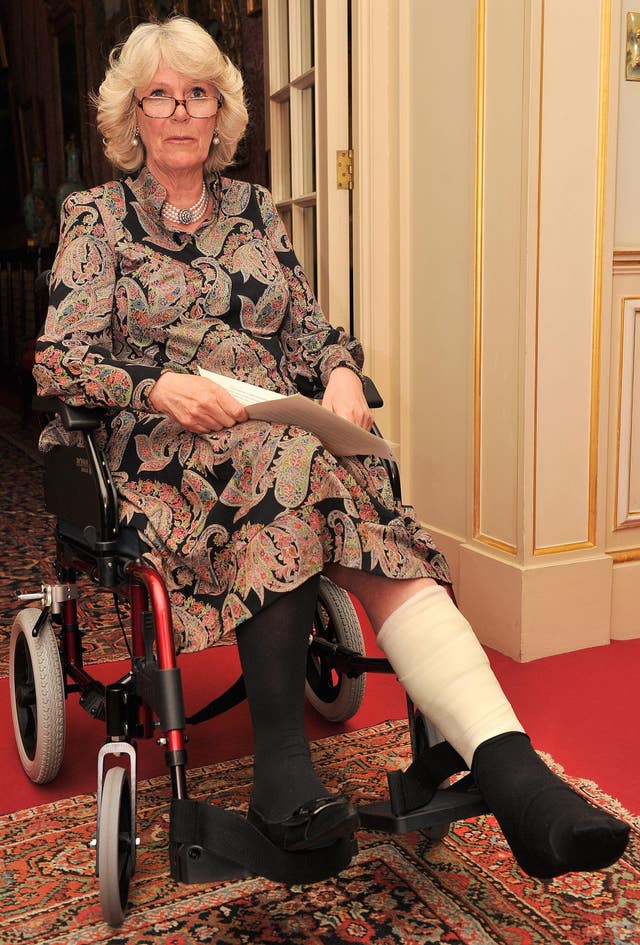 Camilla with her leg in plaster