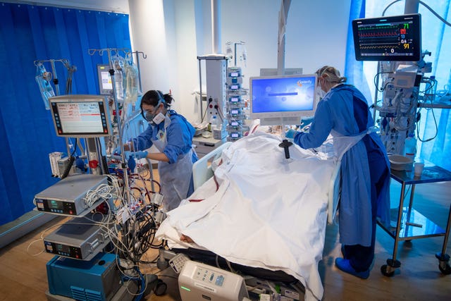 The longest that a patient has been on an ECMO machine at the hospital is around 70 days